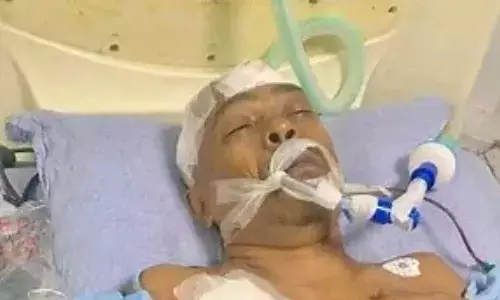 चिन्मय दास के वकील पर हमला, आज होनी है अदालत में जमानत याचिका पर सुनवाई