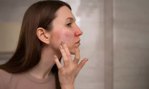 त्वचा को निखारने के लिए अपनाएं ये 3 घरेलू उपाय, जानें एक्सपर्ट से