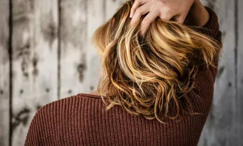 बालों में लगाना शुरु करें कपूर, डैंड्रफ के अलावा रूखेपन से भी मिलेगा छुटकारा