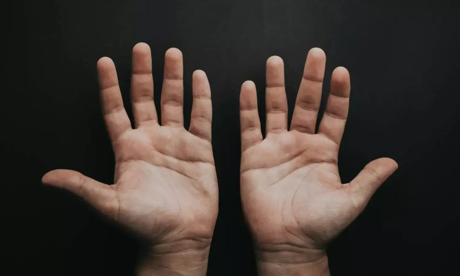 ठंड में सूजी हुई उंगलियों को कैसे करें ठीक, जानें इसका उपाय ठंड में सूजी हुई उंगलियों को कैसे करें ठीक, जानें इसका उपाय