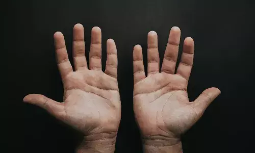 ठंड में सूजी हुई उंगलियों को कैसे करें ठीक, जानें इसका उपाय