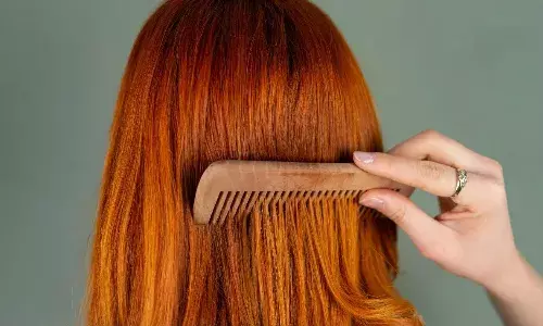 नींबू में बस ये मिलाकर बालों में लगाएं, डैंड्रफ से तुरंत मिलेगा छुटकारा