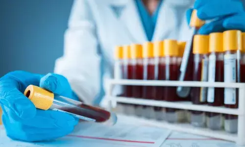 सैंपल कलेक्शन ट्यूब की खरीदी में बड़ा गोलमाल