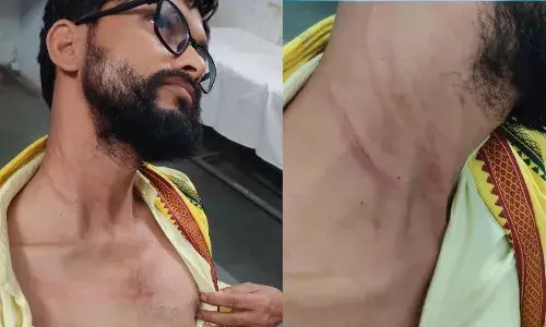 विधायक कमलेश्वर डोडियार के साथ मारपीट, गला दबाने का भी किया गया प्रयास