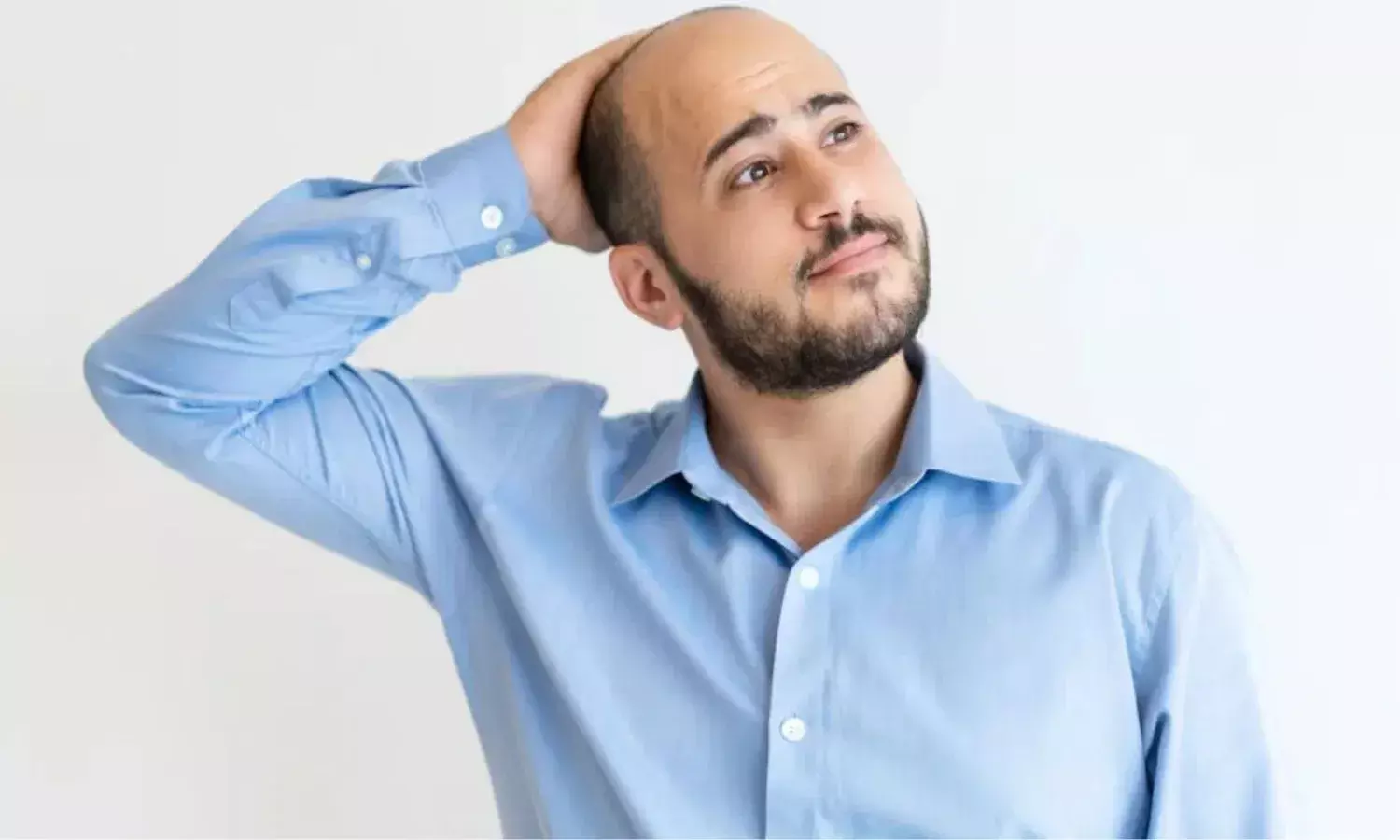 पुरुषों में इन कारणों से होता है गंजापन, जानें क्या है इसके लक्षण, न करें नजरअंदाज