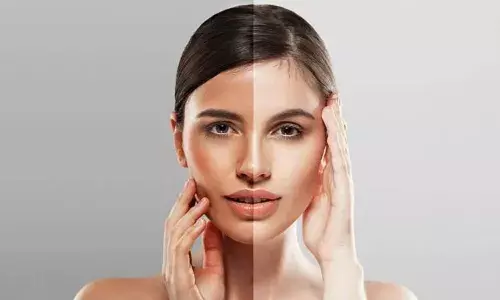 गर्मियों के मौसम में स्किन की टैनिंग से है परेशान, तो इन मास्क से चेहरा बनाएं ग्लोइंग