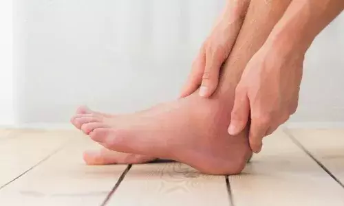 इन घरेलू नुस्खों से एड़ियों की करें देखभाल, गर्मियों में रहेगी एकदम मुलायम