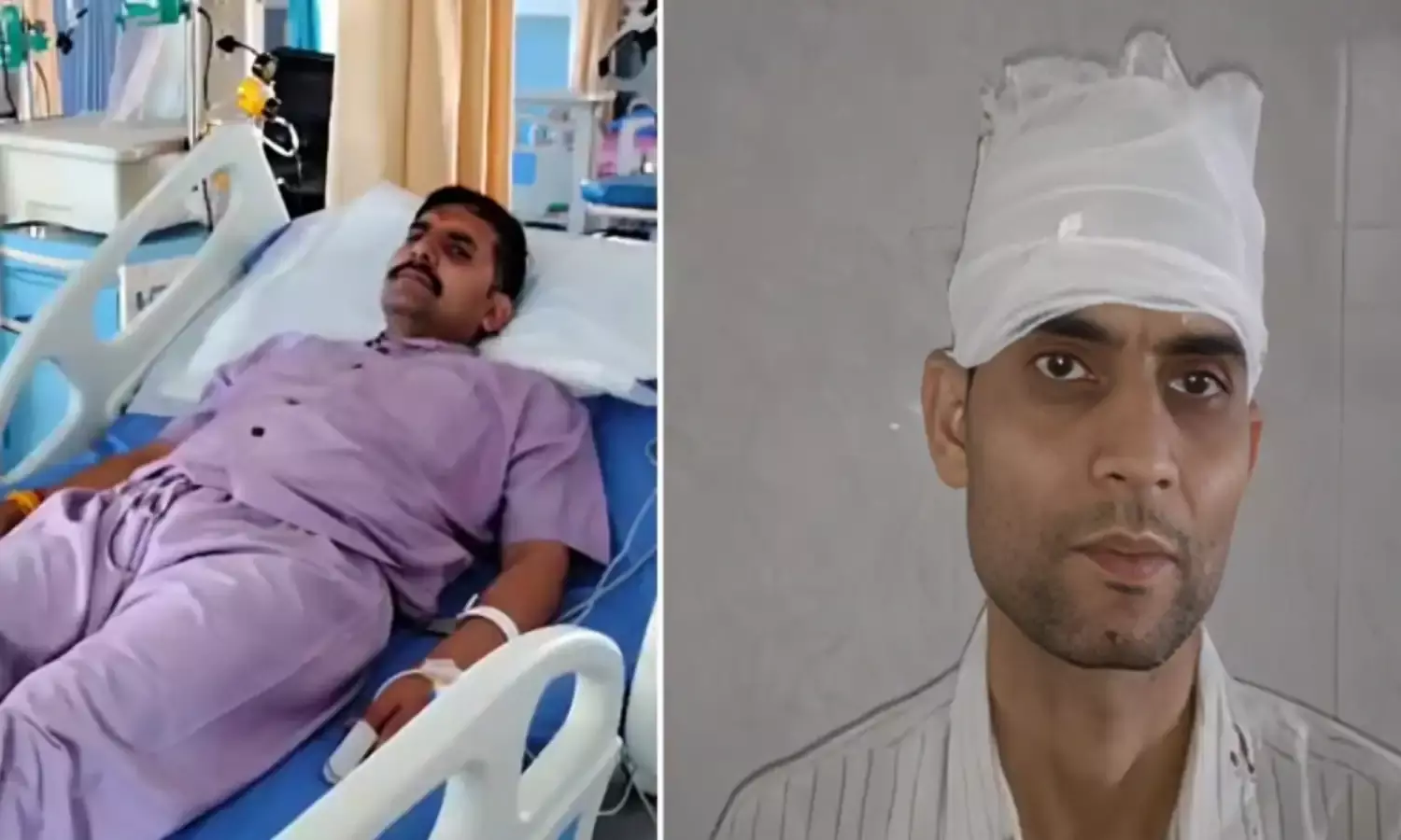 पुलिस पर हमला, सब इंस्पेक्टर घायल, कोर्ट वारंट तामील कराने पहुंची थी टीम...