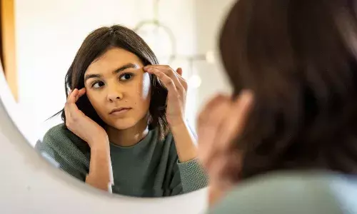 गर्मियों में त्वचा का रखें विशेष ख्याल, नहीं तो हो सकती है समस्या, जानें एक्सपर्ट से गर्मियों में त्वचा का रखें विशेष ख्याल, नहीं तो हो सकती है समस्या, जानें एक्सपर्ट से