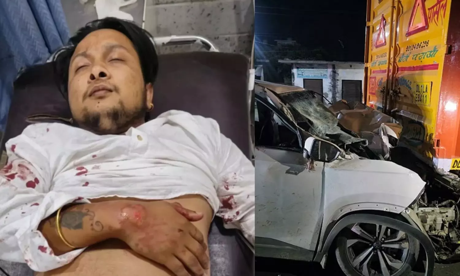 आईसीयू में भर्ती इंडियन आइडल विनर पवनदीप, कार एक्सीडेंट में लगी भयानक चोट