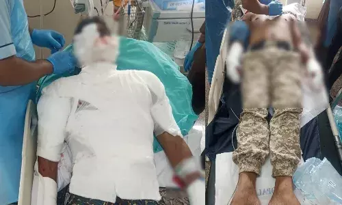 हैंड ग्रेनेड फटने से दो पुलिसकर्मी घायल, एक की हालत गंभीर हैंड ग्रेनेड फटने से दो पुलिसकर्मी घायल, एक की हालत गंभीर