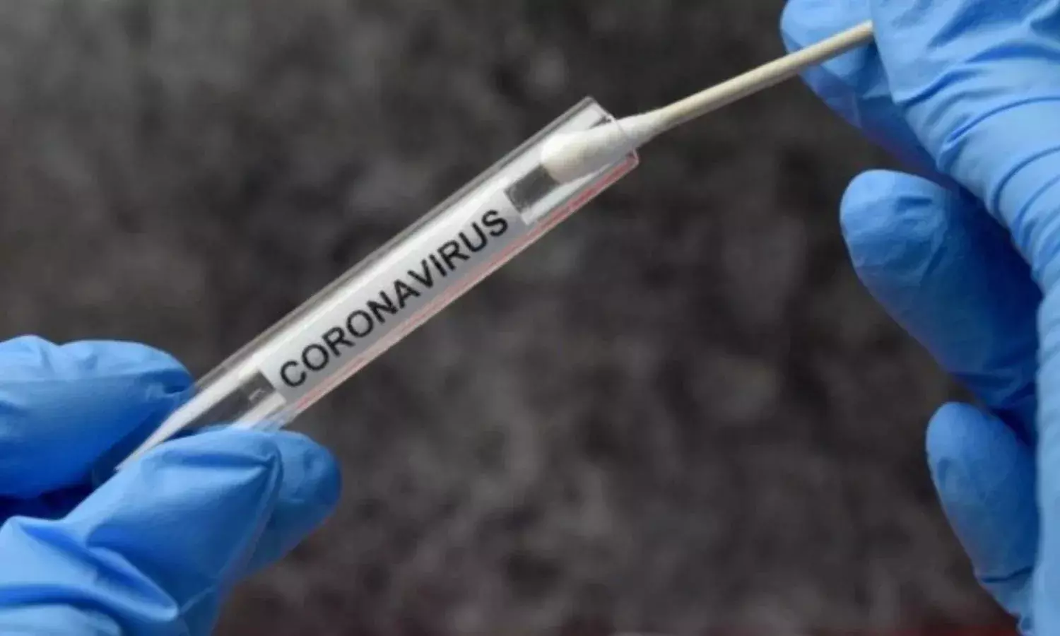 देश में फिर बढ़ रहे कोरोना केस, सक्रिय मामले 6000 के पार, 24 घंटे में 6 मौत दर्ज