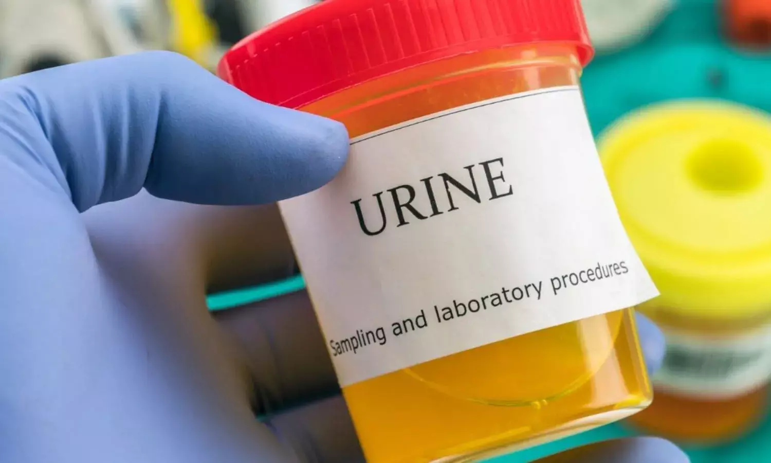 बार-बार पेशाब आना, नजरअंदाज न करें ये संकेत, हो सकती हैं कई गंभीर बीमारियां