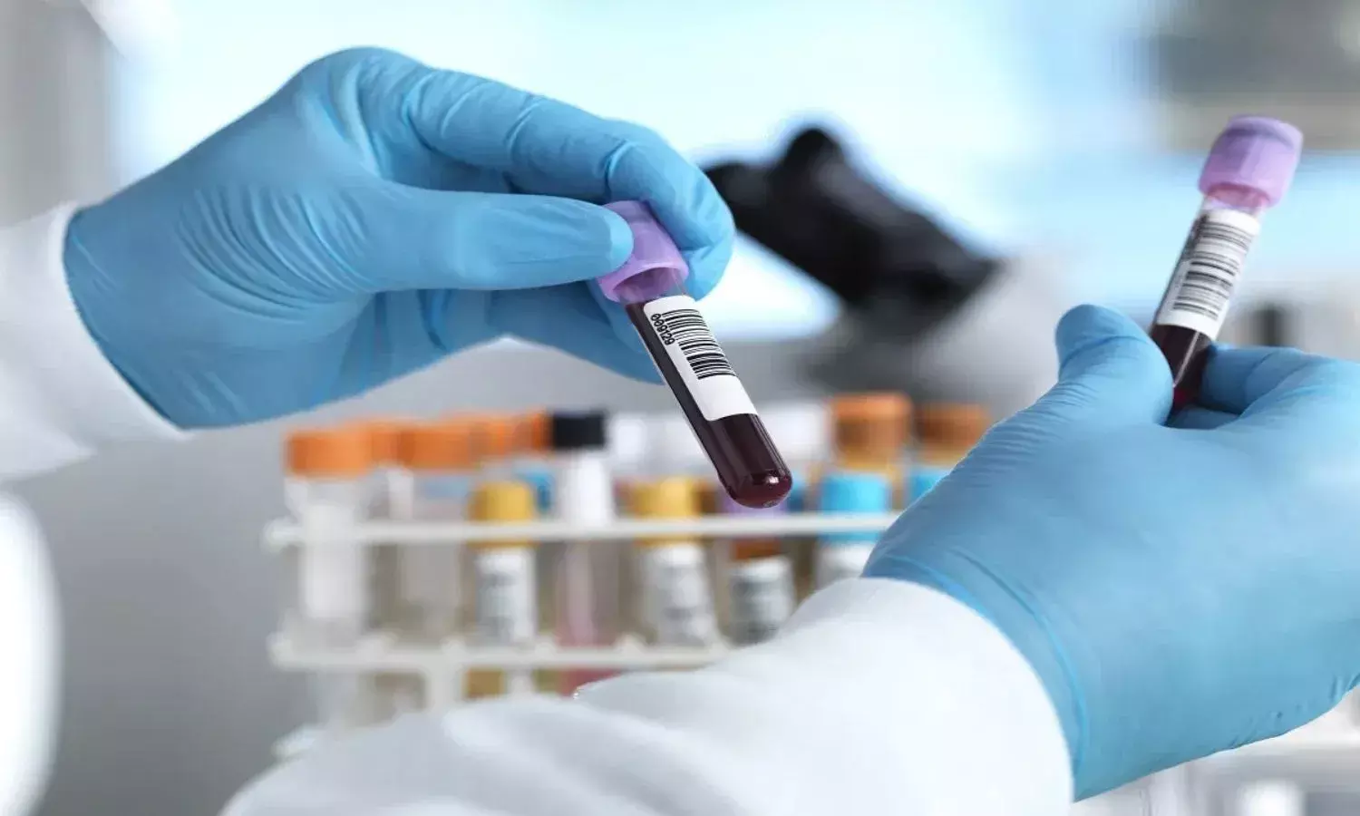 शरीर में हो रही खून की कमी, ये लक्षण देते हैं बड़े संकेत