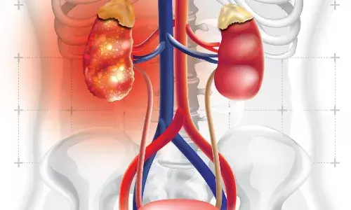 इन आदतों की वजह से किडनी की हो सकती है पथरी, बन सकती है बड़ी परेशानी