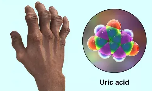 यूरिक एसिड बढ़ना है बेहद खतरनाक, शरीर के इन अंगों को हो सकता है नुकसान