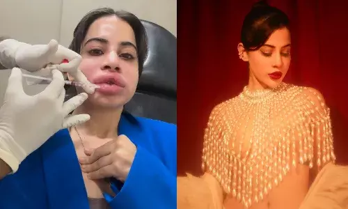 उर्फी जावेद ने शेयर किया चौंकाने वाला वीडियो, चेहरा देख फैंस रह गए हैरान