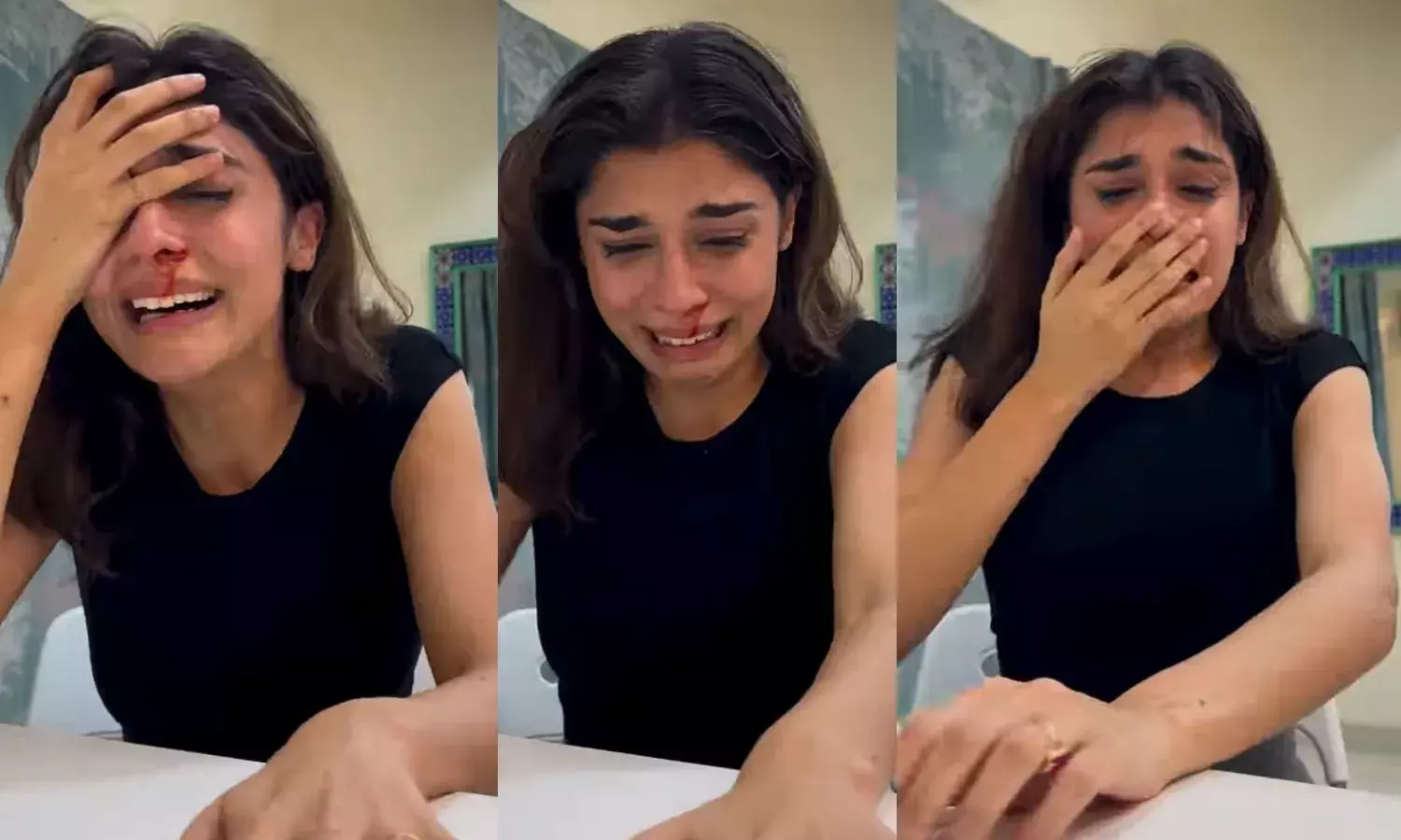 नाक से खून और आंसुओं से भीगा चेहरा, वीडियो से घबराए फैंस; एक्ट्रेस ने बताई सच्चाई