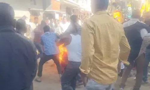 देवास में अतिक्रमण रिमूवल में बवाल, कपल ने खुद को आग लगाई, तहसीलदार पर गिरी गाज