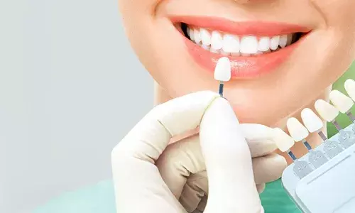 परफेक्ट मुस्कान का ट्रेंड: युवाओं में डेंटल कॉस्मेटिक का बढ़ता क्रेज