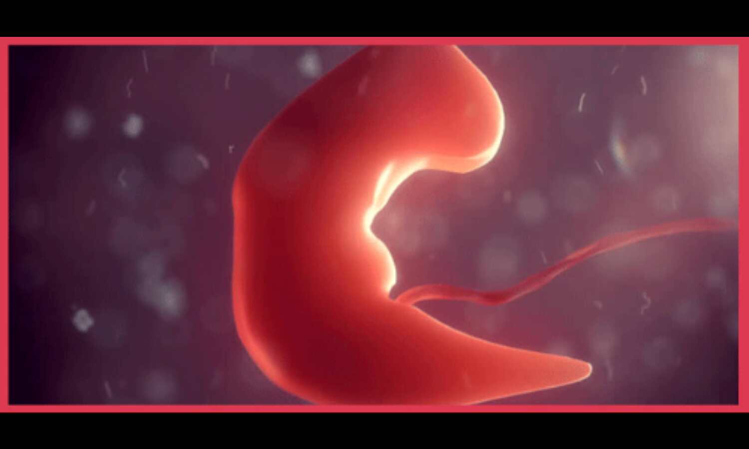 35 दिन के बच्चे के पेट में मिला भ्रूण 35 दिन के बच्चे के पेट में मिला भ्रूण