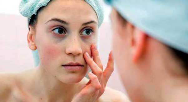 आंखों के नीचे के डार्क सर्कल्स ऐसे करें दूर