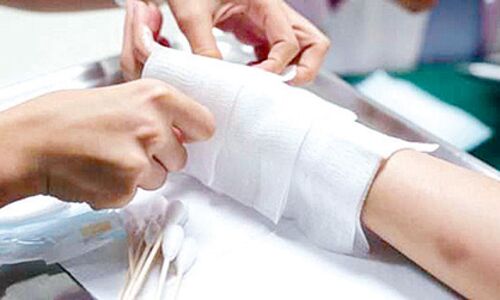 मेडिकल ग्रेड की जगह खरीदी घटिया कॉटन