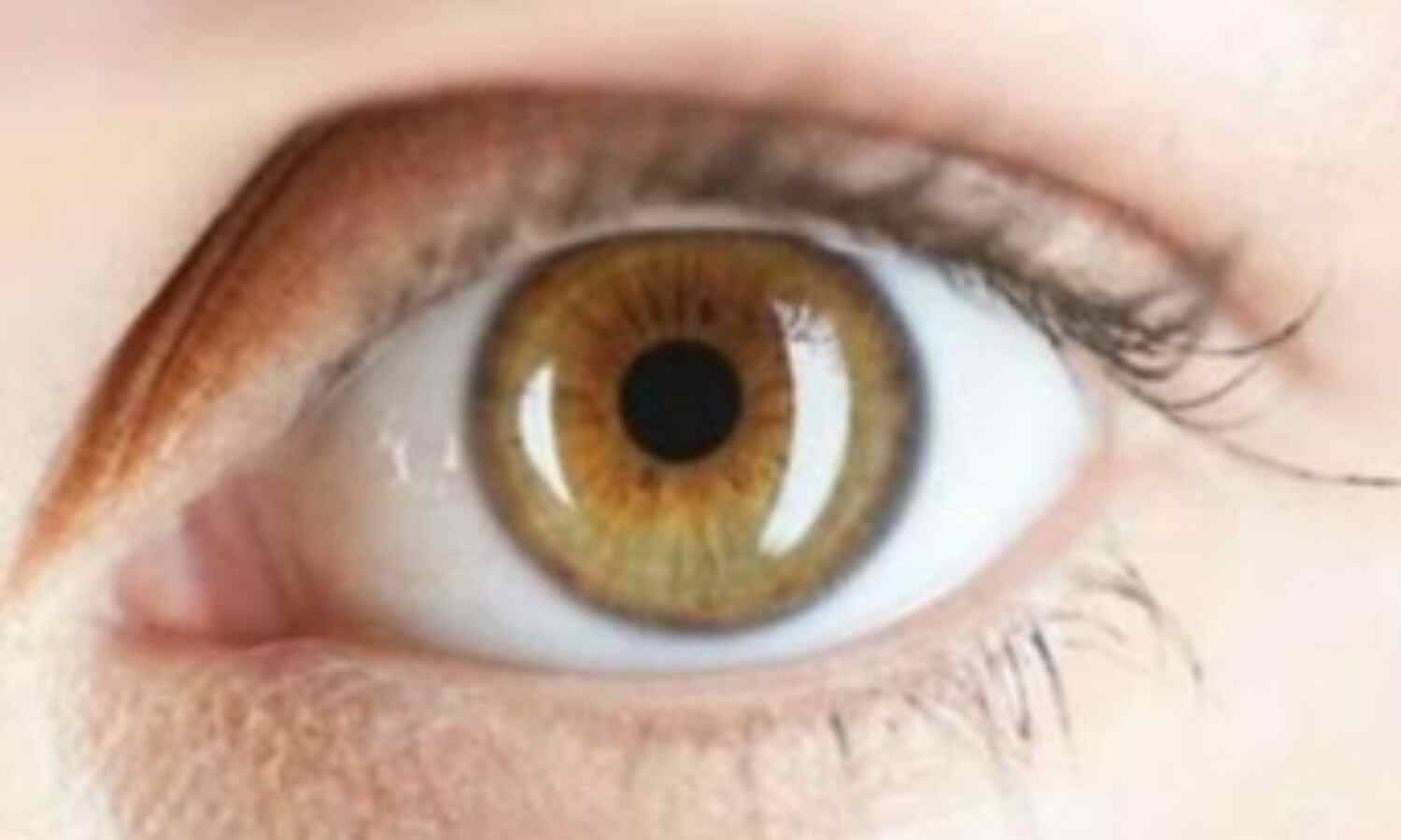 बिन ऑपरेशन लौट आई आँखों की रोशनी!