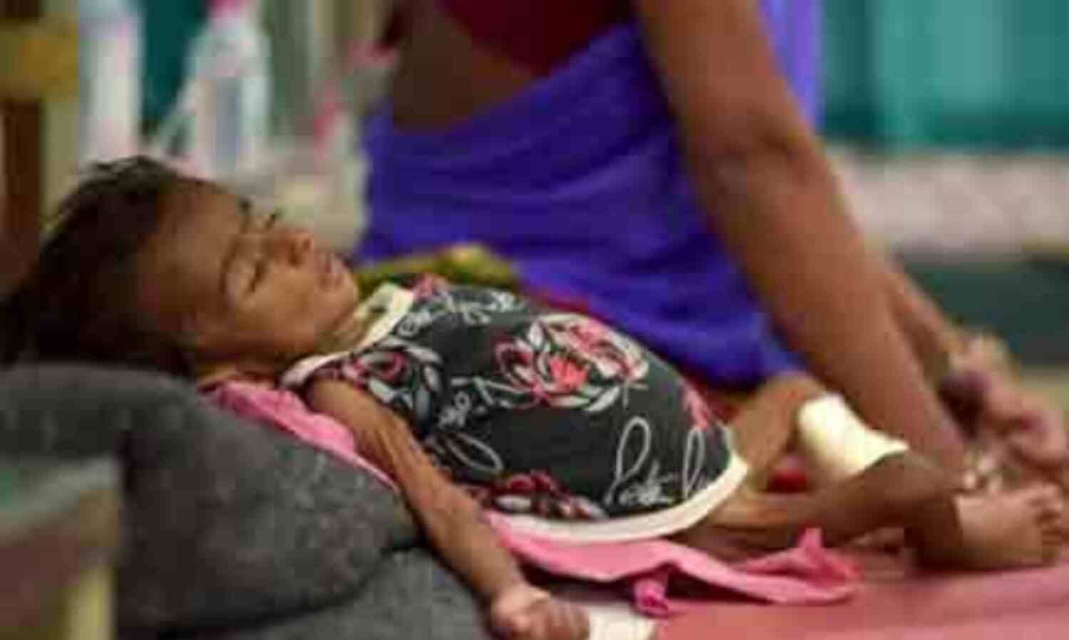 इंडोनेशिया में खसरे ने ली 100 बच्चों की जान