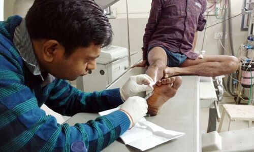 जयारोग्य में पहली बार बर्जर पद्धति से किया सफल उपचार