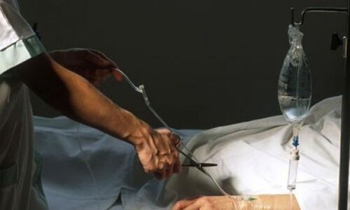 इच्छा मृत्यु को संविधान बेंच की सशर्त मंजूरी